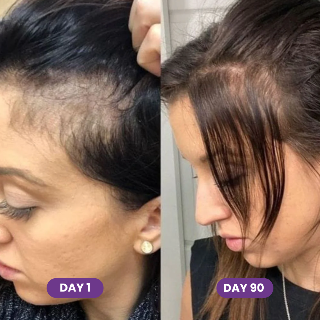 Hair Accelerator Soft Chews