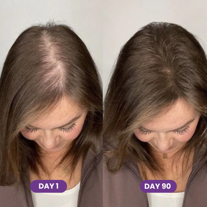 Hair Accelerator Soft Chews